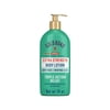 Gold Bond Body Lotion Medicated Extra Strength 14 Oz, 8-Pack