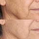 thumbnail image 3 of Crema hidratante Perricone MD, acabado facial, reafirmante, SPF 30, 59 ml, 3 of 5
