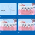 thumbnail image 3 of ACDANC Super Strong Dental Floss Threaders for Braces&Implants,210 Count Value Pack,Easy Clean Bridges&Crowns, 3 of 10