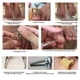 thumbnail image 4 of 2Pcs/Set Foot Care Toenails Lifter Ingrown Nail Paronychia Correction File Pedicure Cleaner, 4 of 4