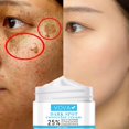 thumbnail image 2 of Crema facial blanqueadora para pecas, elimina eficazmente el Melasma, pigmento de manchas de acné, melanina, manchas oscuras, pigmentación, hidratante para el cuidado de la piel Fivean unisex, 2 of 2