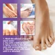 thumbnail image 3 of Spray reparador de onicomicosis Tratamiento de hongos en las uñas Manos Pies Uñas blandas Engrosamiento de uñas Limpieza de uñas Cuidado Hongos Uñas Pies, 3 of 6