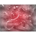 thumbnail image 2 of Microscopic view of hookworm Poster Print, 2 of 2