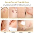 thumbnail image 2 of Silicone Scar Cream Scar Gel, Advanced Scar Cream for Surgical Scars, C-Section, Injury, Stretch Marks, Acne, Burns, Keloids, Old & New Scars, 1.85 Oz (55g), 2 of 7