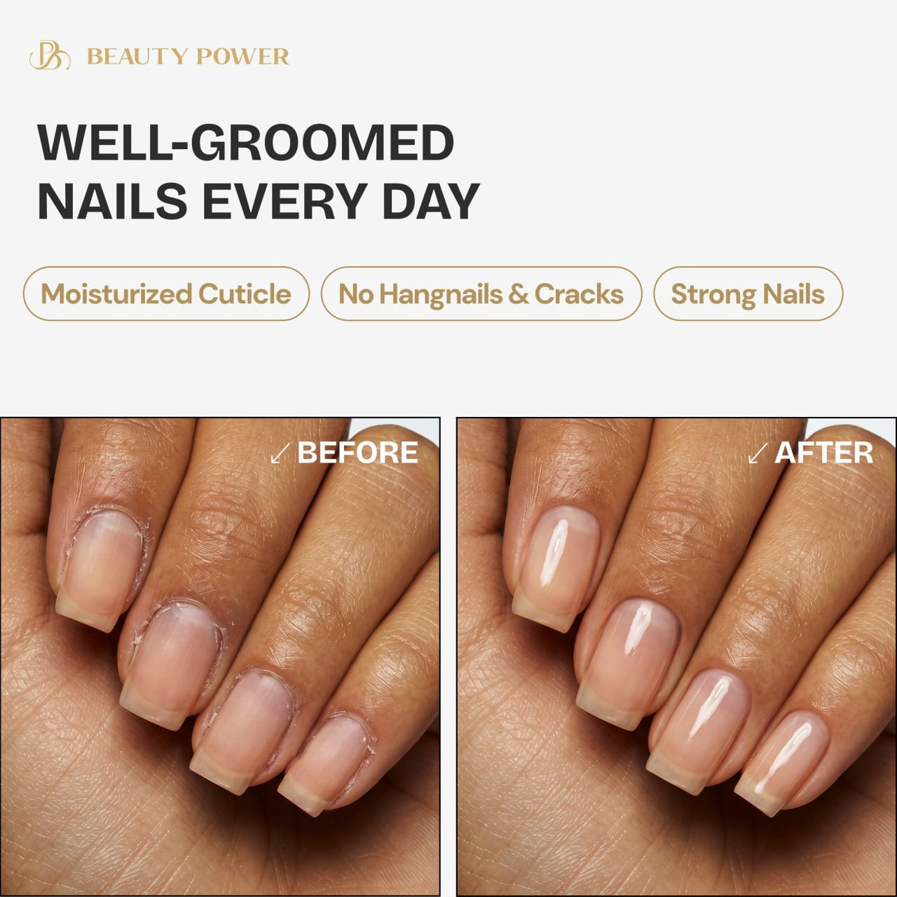 Beauty Power Nail Oil Cuticle Pen - Pineapple - Nail Strengthener & Growth Serum with Vitamin A, D, E, B5, Grapeseed & Natural Oils - Repair for Brittle, Peeling, Thin Nails - Twist Brush Pen