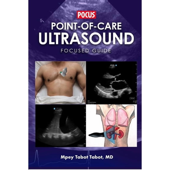 Point-Of-Care Ultrasound Focused Guide, (Paperback)