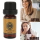 thumbnail image 1 of Aceite De Masaje De Jengibre, 10 Ml Alivia El Dolor Aceite Esencial Natural Hidratante Soluble En Agua Relaja Los Músculos Calma La Mente Para El Baño De Pies, 1 of 7
