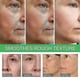 thumbnail image 2 of Intensive Anti- Serum Facial Firming, Ening Lines A #calu, 2 of 4