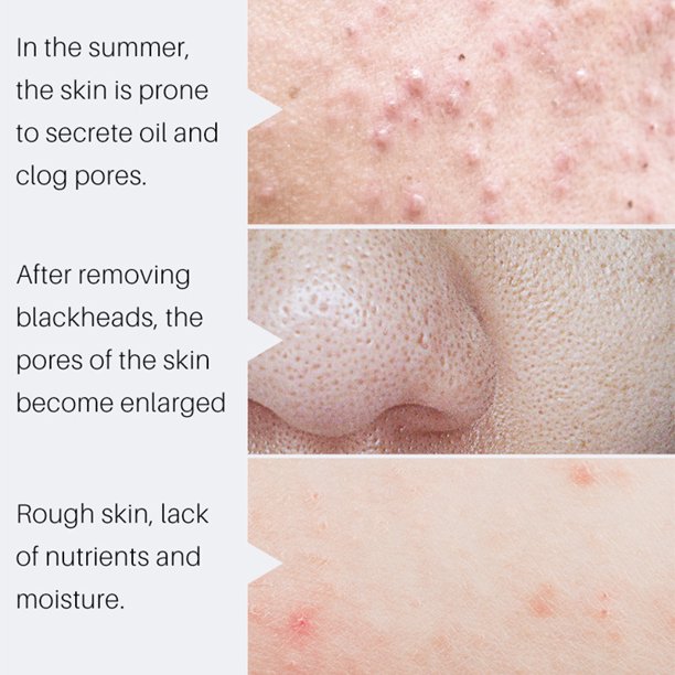 Shrink Pores Essence Professional Skin Care Supplies Peptide Serum and