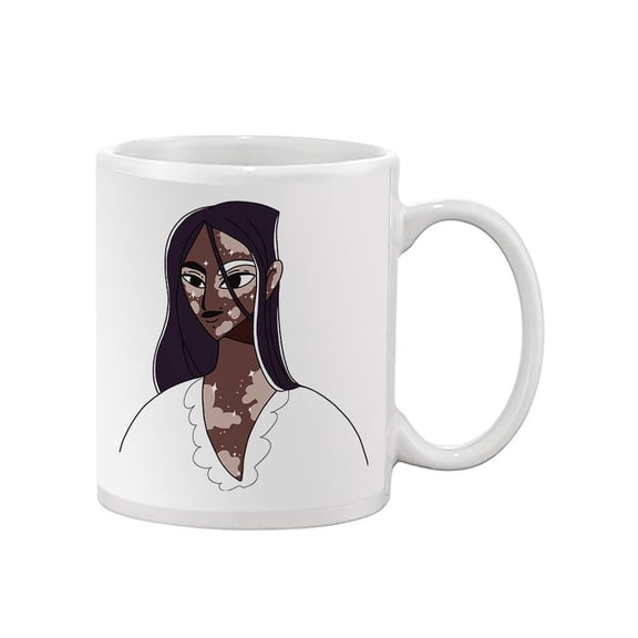 Beautiful Vitiligo Woman Mug - Image by Shutterstock,
