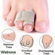 thumbnail image 3 of 8-pack Of Hammer Toe Straighteners For Straightening Hammer Toes, Broken Toes, Crooked Toes And Overlapping Toes, 3 of 5