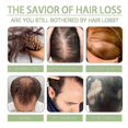 thumbnail image 4 of OUHOE Hair Loss Oil Firms Hair, Prevents Hair Loss, Strengthens Hair, Cleans Scalp, Repairs Smoothness, Hair L, 4 of 4