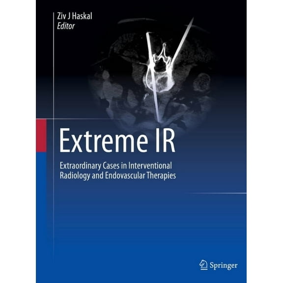 Extreme IR: Extraordinary Cases in Interventional Radiology and Endovascular Therapies, (Hardcover)