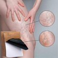 thumbnail image 5 of JAYSUING 12Pcs Varicose Veins Patches Skin-friendly Non-toxic Improve Varicosity Dredge Vein Relieve 26-27s, 5 of 5
