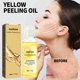 thumbnail image 2 of Aceite esencial blanqueador y eliminador de manchas, exfoliante, blanqueador e hidratante de la piel, 50 ml a essence, 2 of 5