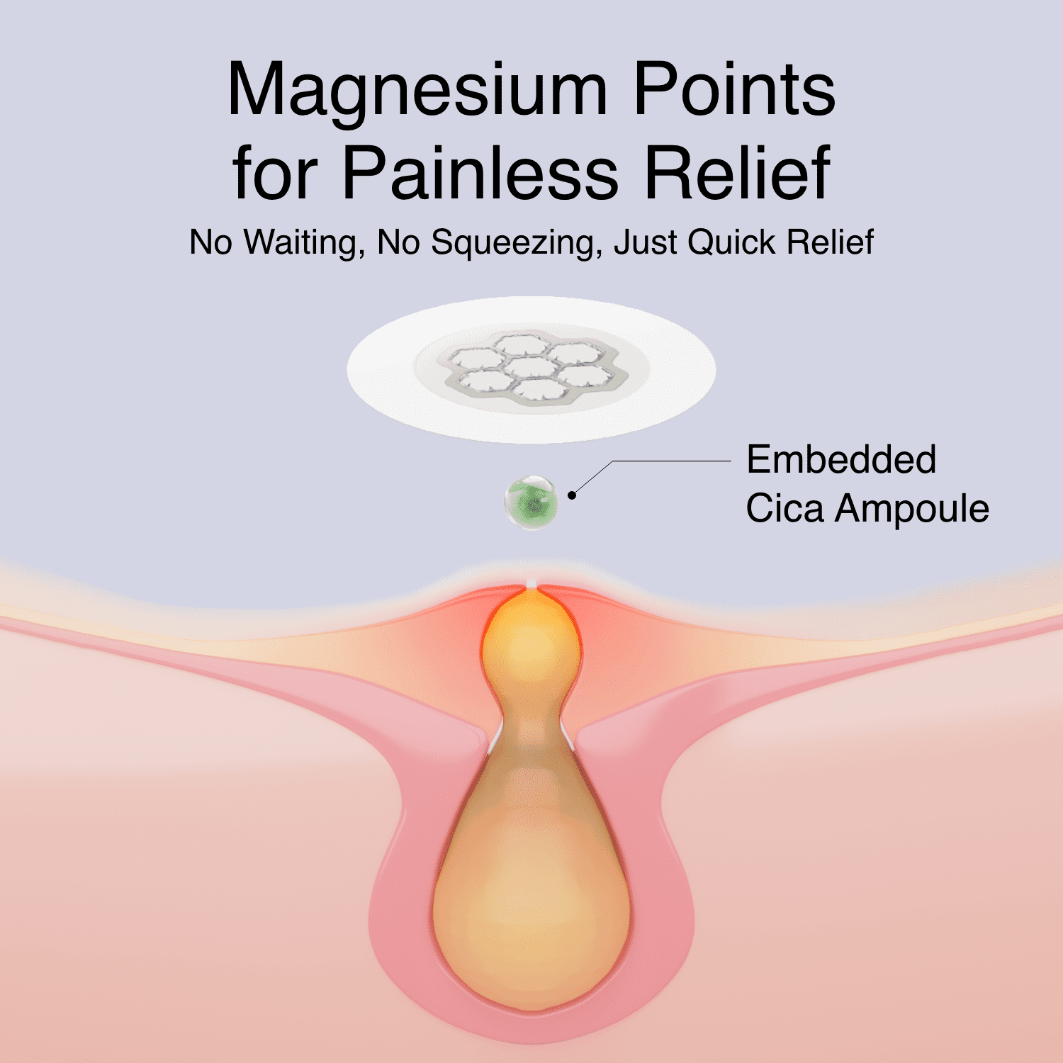 Easyderm Quick Calming Magnesium Hydrocolloid Acne Spot Patches with Cica Ampoule, 20 Count
