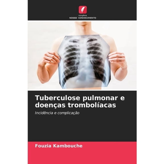 Tuberculose pulmonar e doenças trombolÃÂacas, (Paperback)