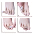 thumbnail image 3 of Altsales Broken Toe Wraps Cushioned Bandages,Toe Splint, Hammer Toe Straightener, Toe Wraps for Overlapping, Fractured or Injured Toes, 3 of 8