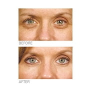 Stem Cell Therapy Eye Repair