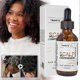 thumbnail image 2 of 1-3pcs Natural Hair Growth Oil for Women & Men Advanced Scalp Care Serum for All Hair Types - Deep Nourishment & Regrowth Solution, 2 of 5