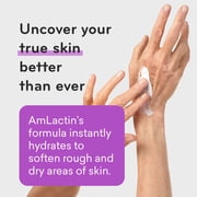AmLactin Ultra Smoothing Intensely Hydrating Body Cream with Lactic Acid, 4.9 oz