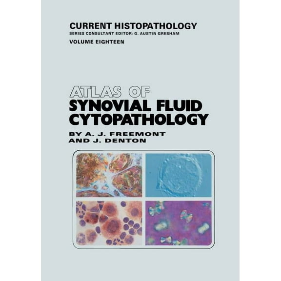 Current Histopathology Atlas of Synovial Fluid Cytopathology, Book 18, (Paperback)