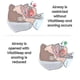thumbnail image 5 of Adjustable Mouth With Silicone Anti-snoring Device, Anti-snoring, Anti-brushing Braces, 5 of 5
