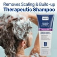 thumbnail image 3 of MG217 Psoriasis Scalp Solutions Shampoo + Conditioner 8 Oz, 3 of 5
