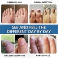 thumbnail image 5 of Effective Solution for Nail Fungus on Hands & Feet, Repairs Discolored Nails, Shields Thick or Damaged Nails, 5 of 5