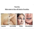 thumbnail image 3 of Derma Wand, Anti-aging Face - Rf Beauty Instrument Massage Eu Plug LONG, 3 of 4