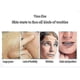 thumbnail image 3 of Derma Wand, Anti-aging Face - Rf Beauty Instrument Massage Eu Plug LONG, 3 of 4