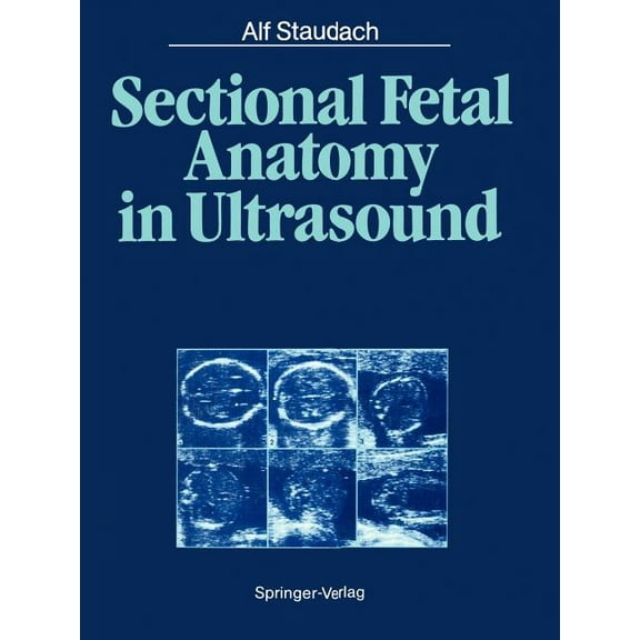 Sectional Fetal Anatomy in Ultrasound, (Paperback)