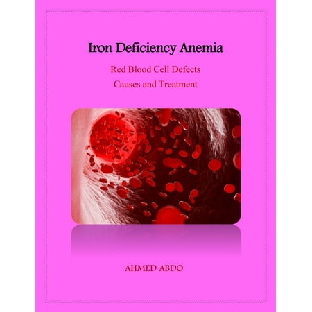 Iron Deficiency Anemia - eBook (Best Treatment For Iron Deficiency Anemia)