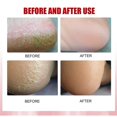 thumbnail image 2 of Crema para pies Leke anticongelante, antisequedad, hidratante, reparadora, seca, descamada, áspera y agrietada | 4404854745067, como en la imagen, 2 of 5