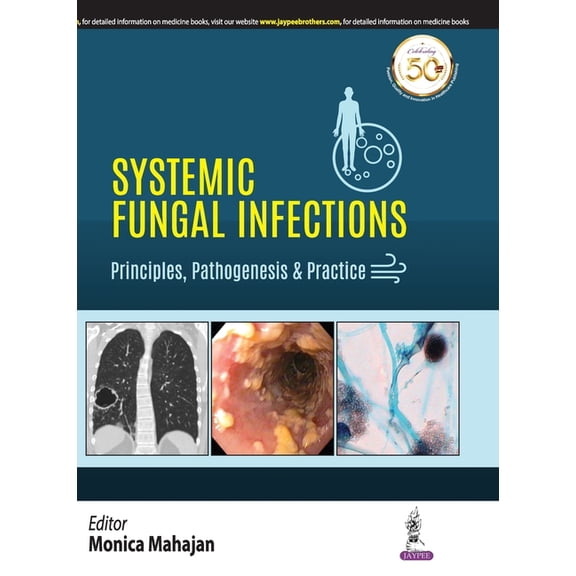 Systemic Fungal Infections, (Hardcover)