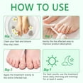 thumbnail image 6 of Nail Treatment, 7-Day Nail Fungus Treatment, Nail Repair & Strengthen Cuticles, 2.02 FL.OZ, 6 of 8