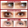 thumbnail image 3 of Milia Remover Milia Spot Treatment ayuda a disolver y reducir el suero facial Milia, 3 of 5