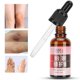 thumbnail image 5 of Crema Para Aclarar La Piel, Componente De Planta De Crema Para Blanquear La Piel De Múltiples Funciones Ligeras Para Axilas Para Mujeres Para Partes Privadas Para Niñas ANGGREK Skin Whitening Cream, 5 of 8