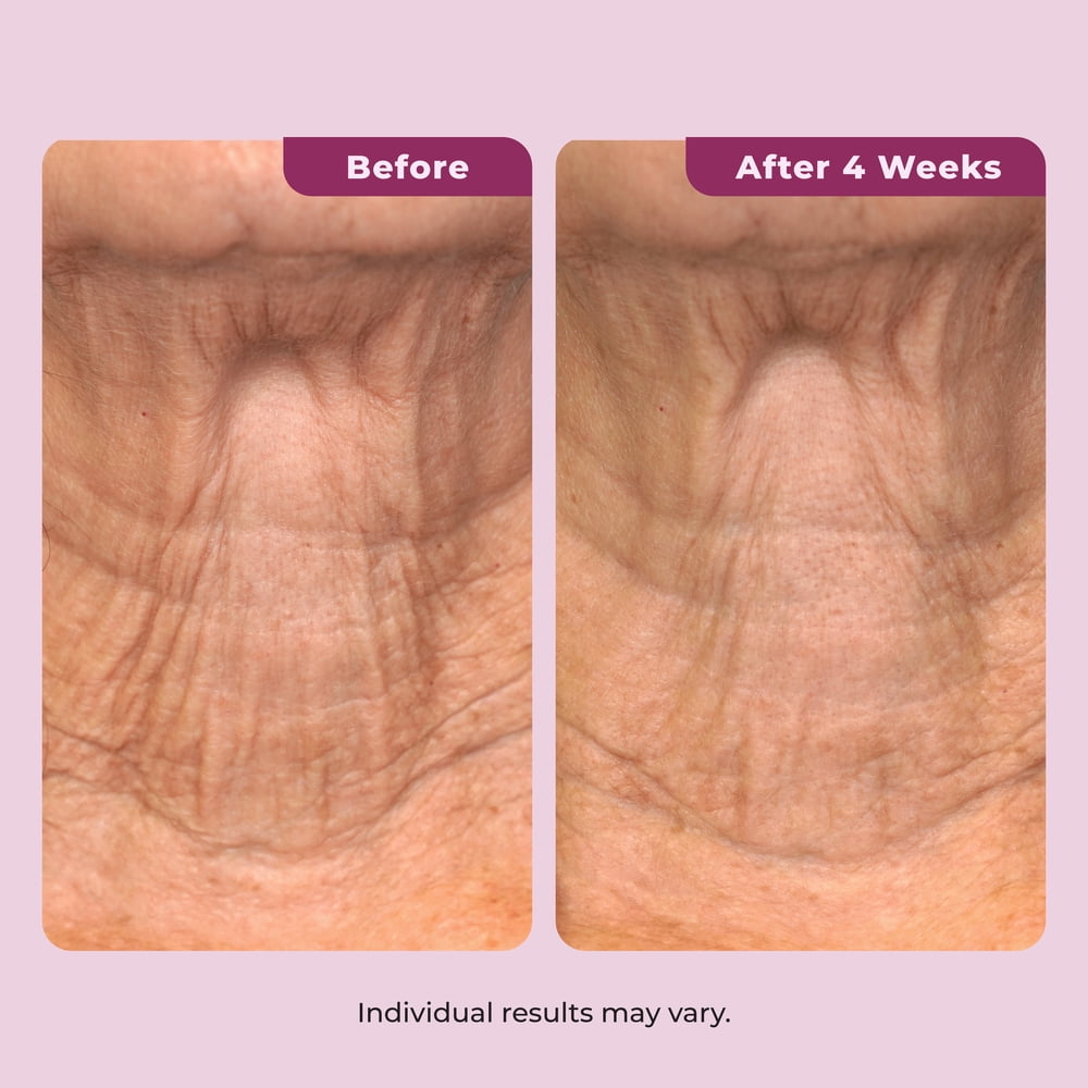 Dekliderm Neck Firming Cream for Neck, Chest & Arms – Tightening and Smoothing Cream for Crepey Skin, Wrinkles & Sagging Appearance