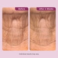 thumbnail image 5 of Dekliderm Neck Firming Cream for Neck, Chest & Arms – Tightening and Smoothing Cream for Crepey Skin, Wrinkles & Sagging Appearance, 5 of 9
