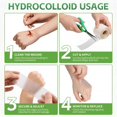 thumbnail image 6 of OITY Hydrocolloid Roll for Wound Care 2In X 16Ft,Extra Large Hydrocolloid Patch Bandages with Self-Adhesive,Cut-To-Size Ultra Absorbent,Flexible&Waterproof, 6 of 8