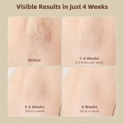Laser Hair Removal for Women & Men, 999999 Flashes Painless IPL Hair Remover, Hair Removal Device for Armpits Legs Arms Bikini Line, White