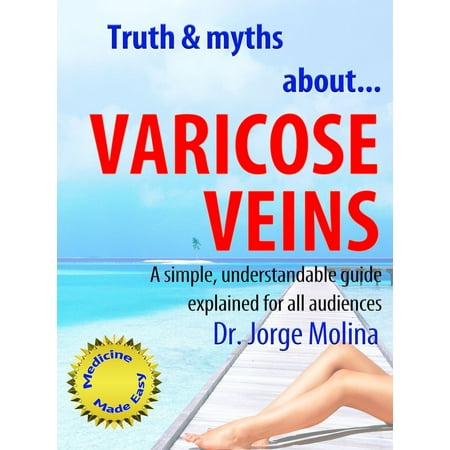 Truth & Myths About... Varicose Veins - eBook