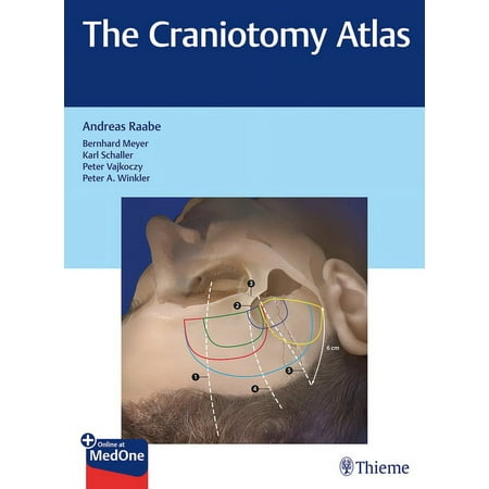UPC: 9783132057913 | The Craniotomy Atlas (Hardcover)