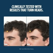 Nutrafol Men’s Shampoo and Conditioner 2 in 1, Cleanses, Hydrates, Unclogs Pores, Improves Volume & Strength, Physician-formulated for Thinning Hair