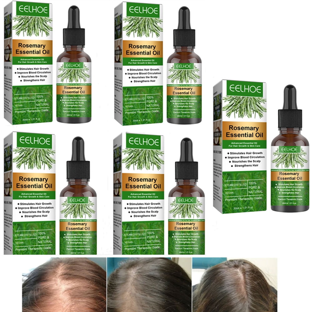 Hair Care Essential Oil for Hair Growth, Rosemary Water Serum Hair Growth  Serum for Thinning Hair and Hair Loss Promotes Thicker, Hair Growth  Essential Oil for Women and Men (30ml-5PCS) 