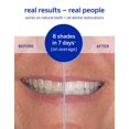 Supersmile Dissolving Superstrips DHF10 Professional Teeth Whitening