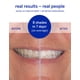 thumbnail image 3 of Tiras blanqueadoras de dientes Supersmile Dissolve Superstrips, 3 of 6