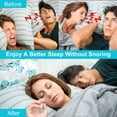 thumbnail image 3 of MySmile 6pc Small Anti Snoring Dilators Device, Snore Stopper Nose Vents Nasal Dilator Breathing Sleeping Relief, 3 of 6