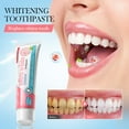 thumbnail image 4 of SDJMa Rose Salt Whitening Toothpaste – Gently Removes Stains & Freshens Breath with Natural Mint & Xylitol, 100g, 4 of 9